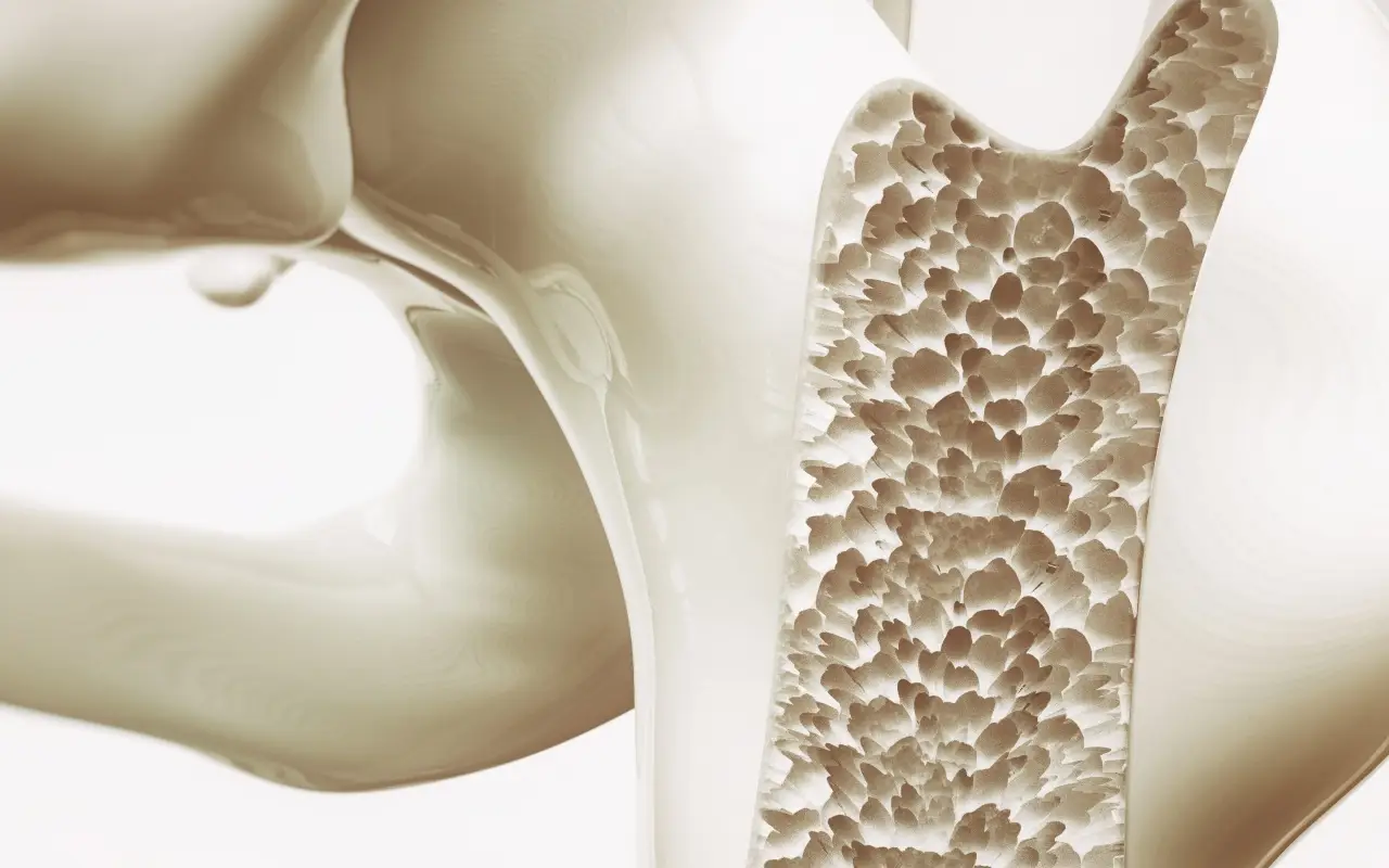 Come prevenire l’osteoporosi con l’alimentazione corretta Immagine selezionata